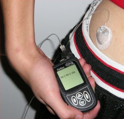Insulin pump and infusion set.