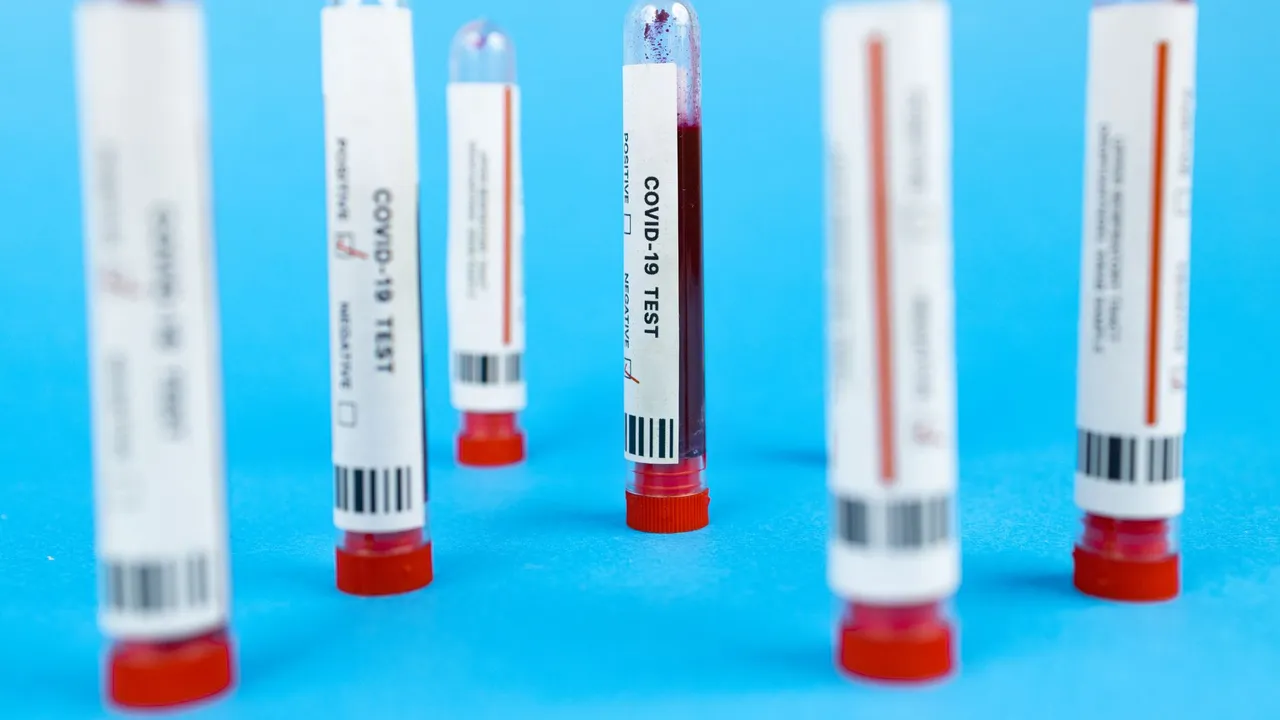 Close-up of COVID-19 blood test tubes on blue background, representing pandemic testing.