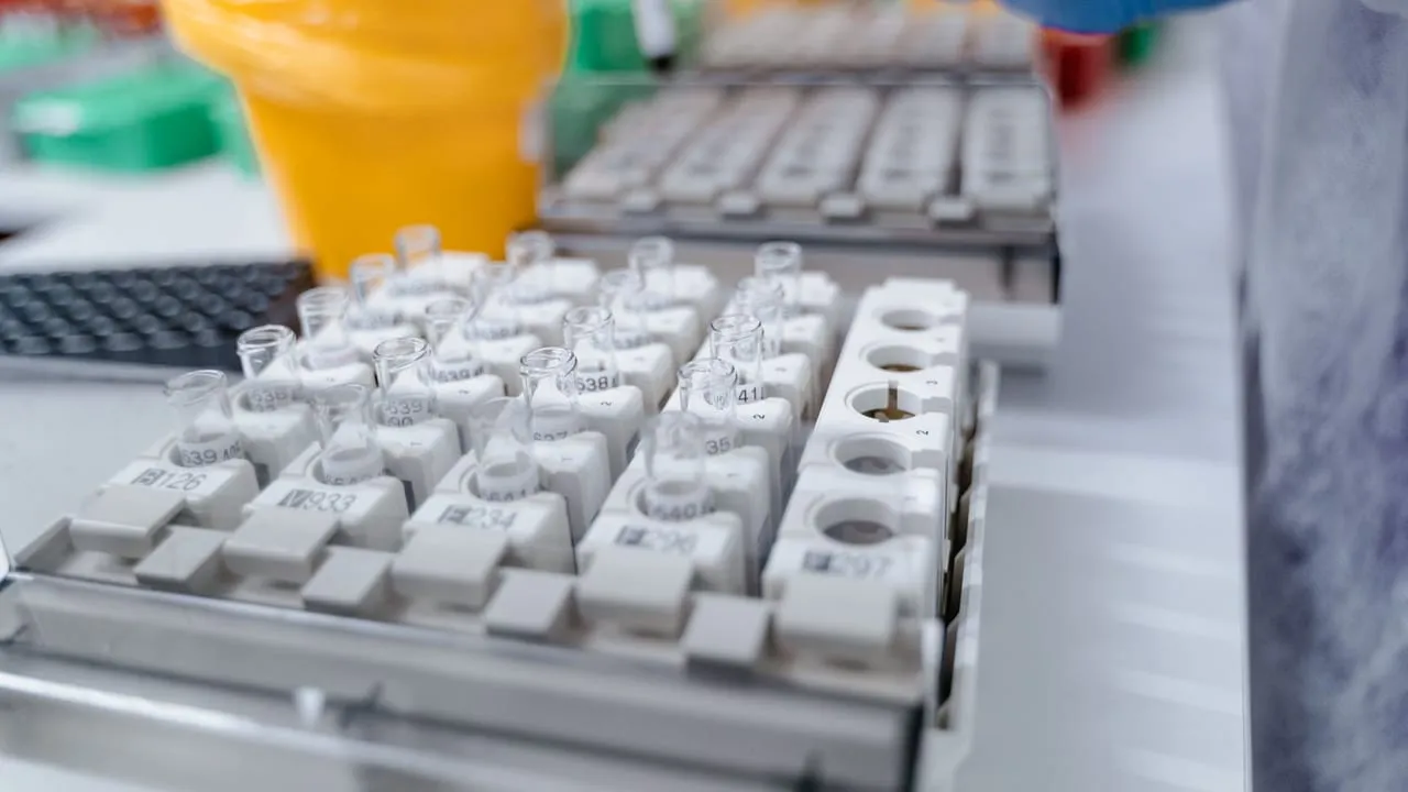 Close-up of test tubes in a lab setting with a technician handling samples. Ideal for scientific research visuals.
