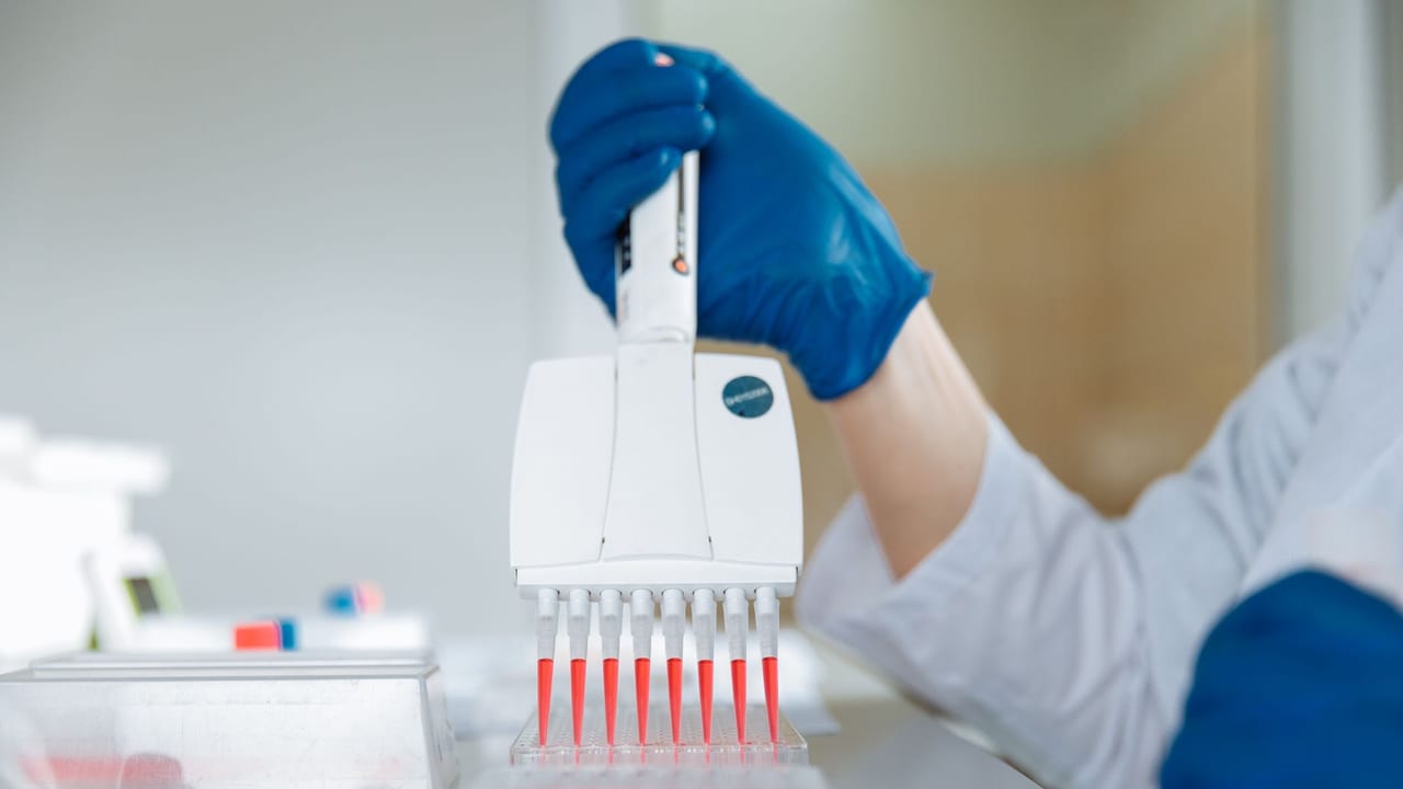 Why People with Down Syndrome Are at Higher Risk for Diabetes