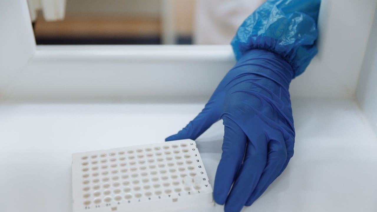 C-Peptide Levels Linked to Type 1 Diabetes Complications