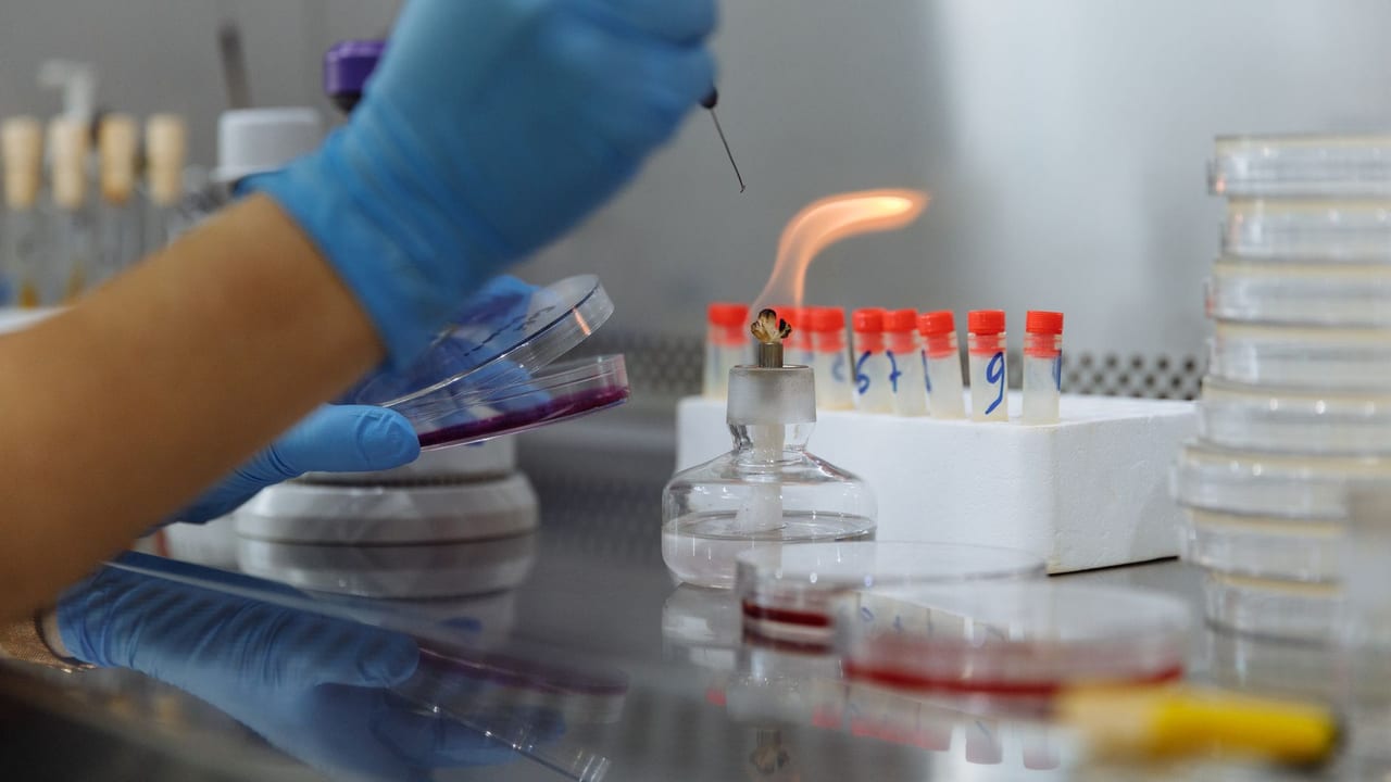 Multimorbidity in Type 1 Diabetes: A Growing Concern