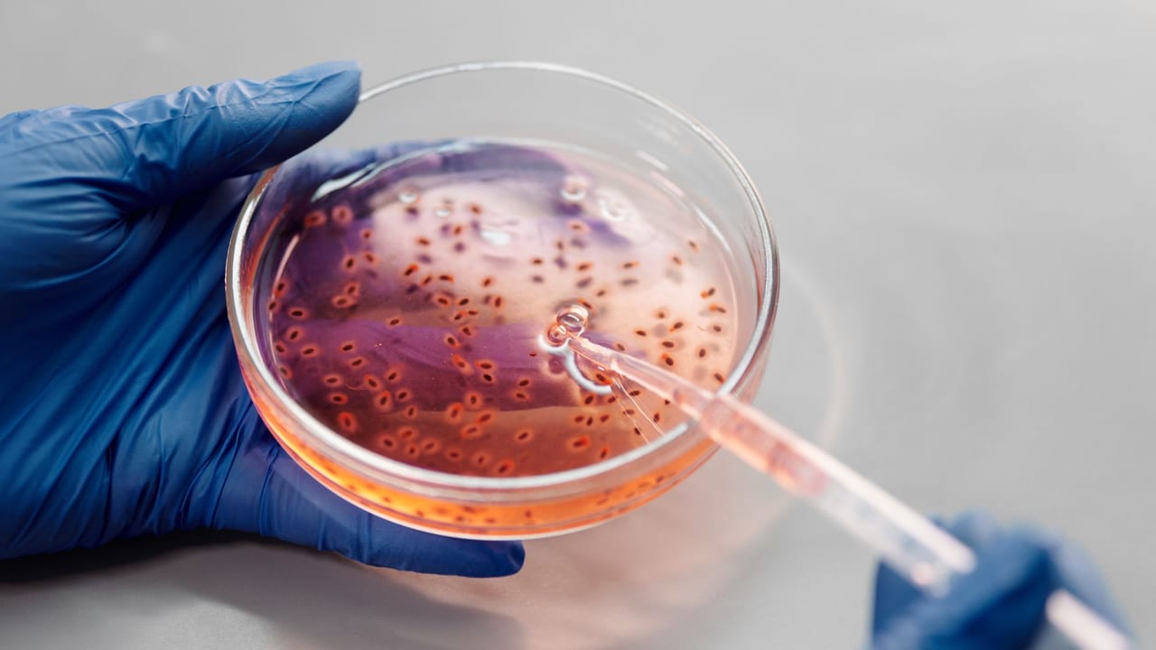 Islet Autoantibodies: A Key to Predicting Type 1 Diabetes in Africa?