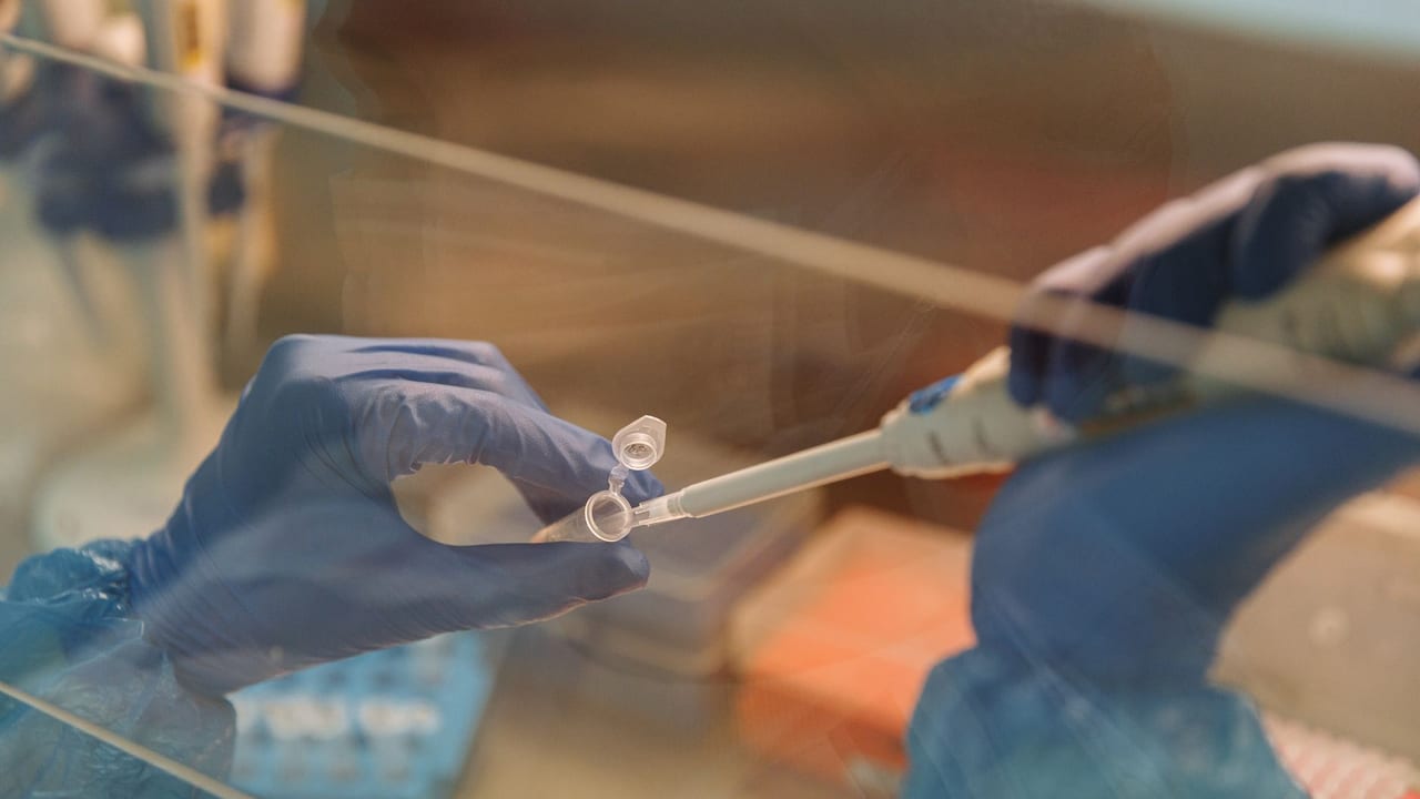 Unlocking the Secrets of Cardiovascular Resilience in Type 1 Diabetes