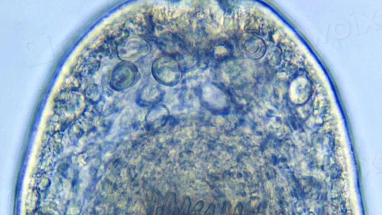 Ultra structural details exhibited by a parasite
