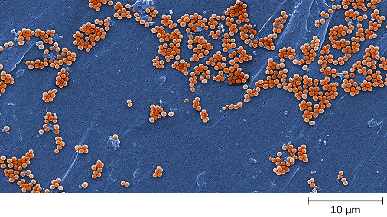 OSC Microbio 04 04 ArtConn2 img