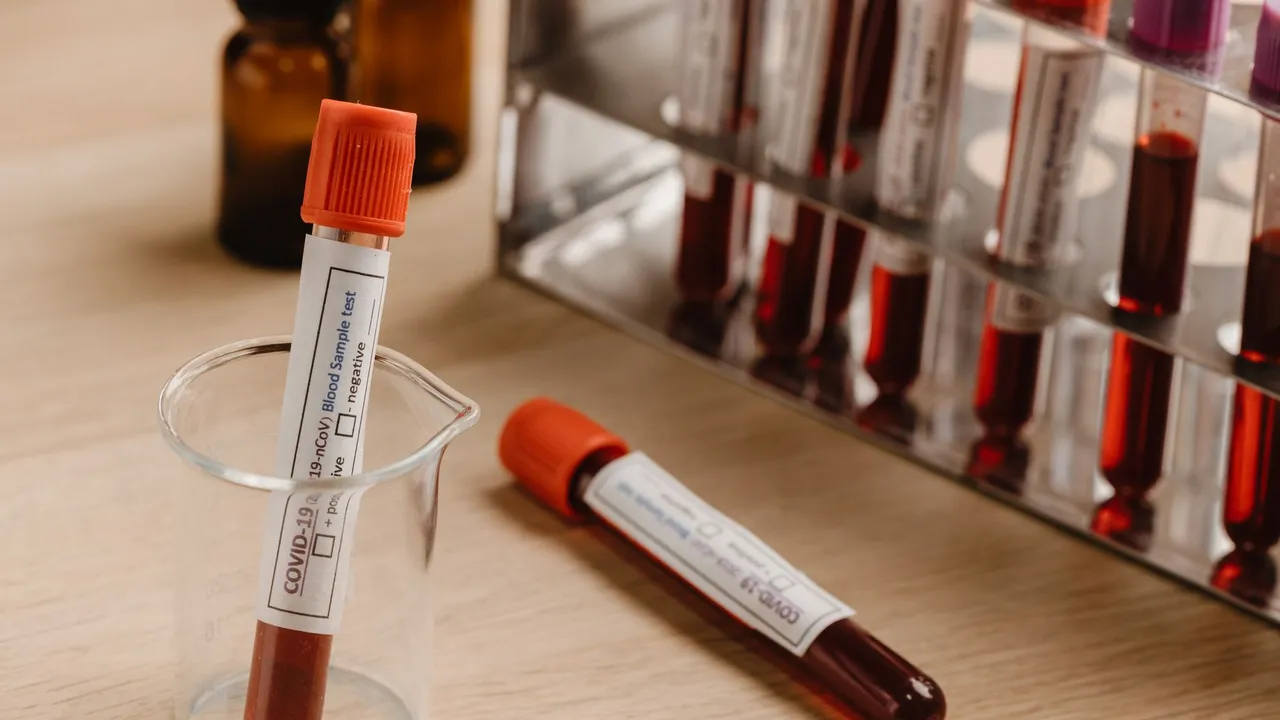 Close-up of blood sample tubes for Covid-19 testing in a laboratory setting.