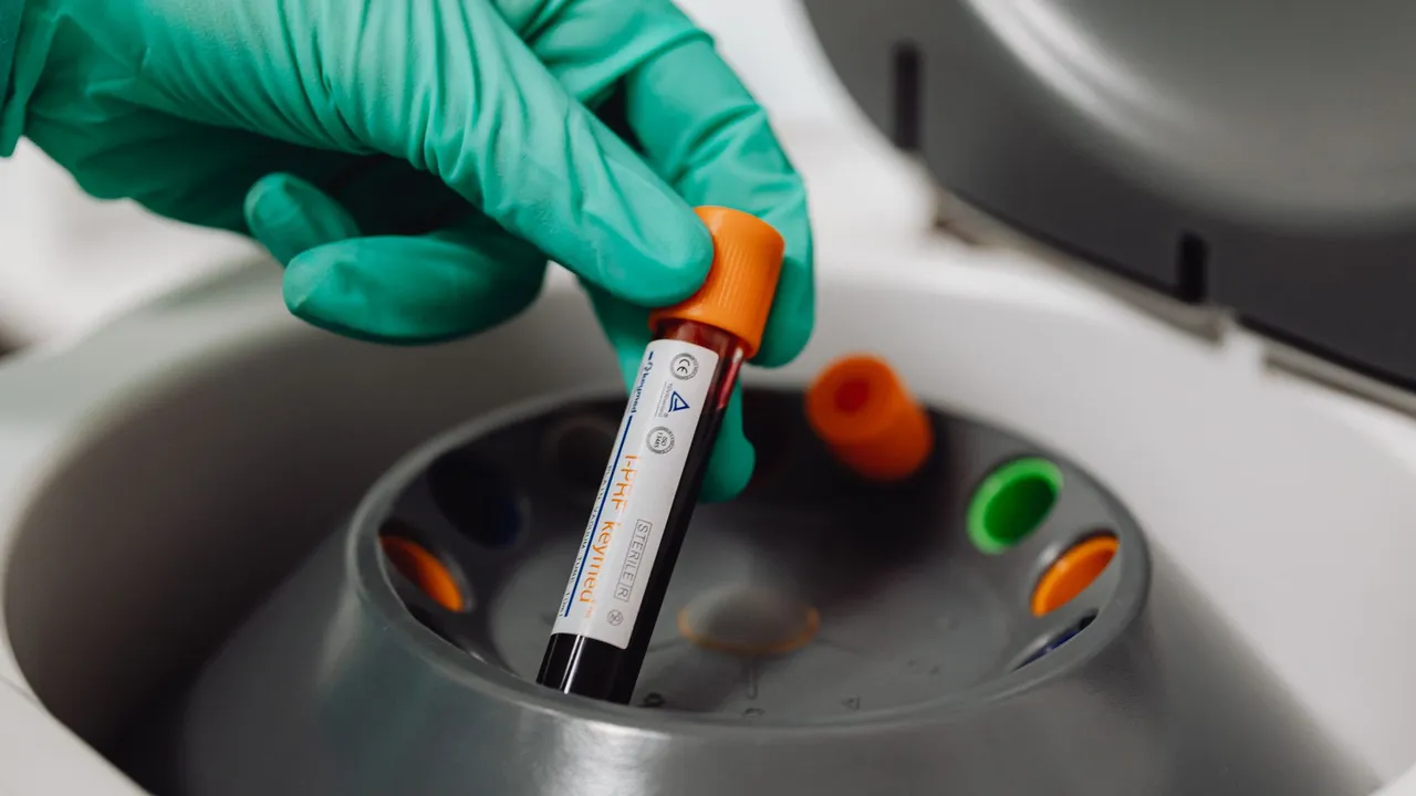 A medical professional holds a blood vial ready for centrifuge in a lab setting.