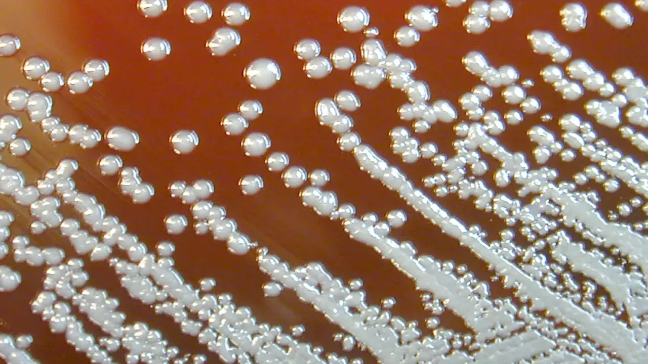 A close view of a Petri dish culture plate, which had contained a growth medium of sheep blood agar (SBA), and which was inoculated with Gram–positive, Bu