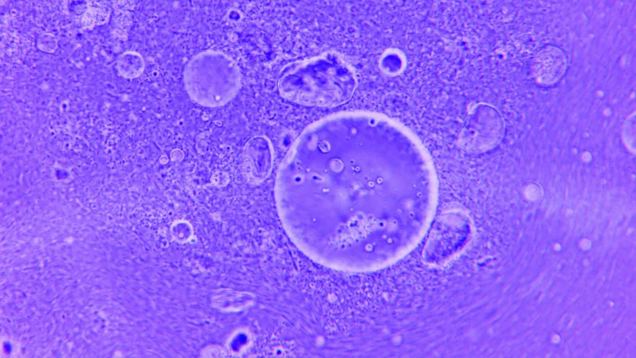 Blue abstract image of water droplets and particles under a microscope.