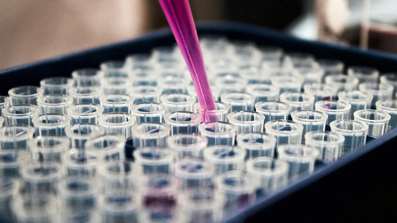 Image from i3p.it: New Collaboration Aims to Make Islet Transplantation More Accessible for Type 1 Diabetes
