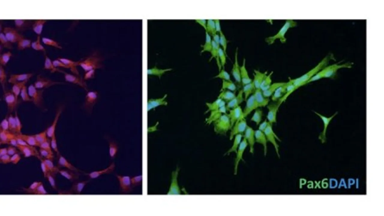 Induced Pluripotent Stem Cells of Huntington's Disease