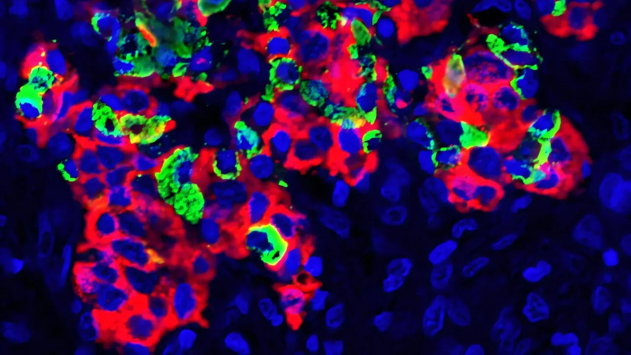 Image from medicalxpress.com: A New Location for Islet Transplants: Why the Spleen Might Change Type 1 Diabetes Treatment