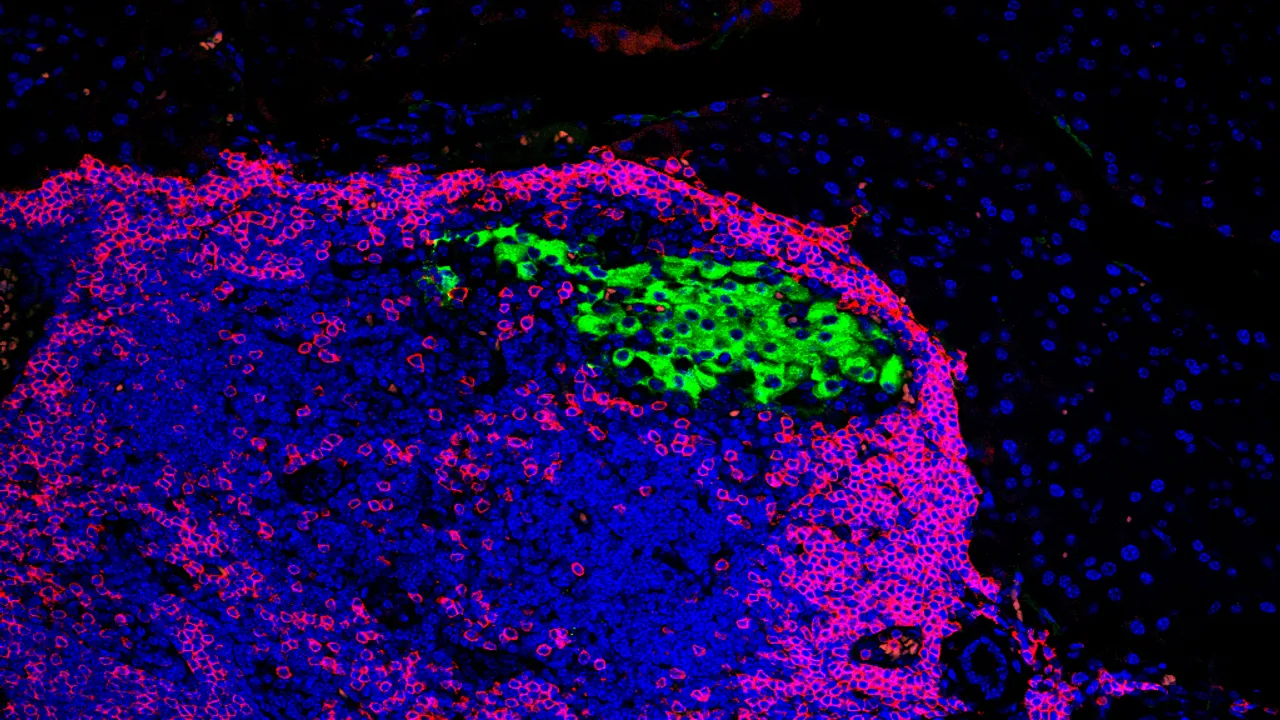 Image from news.wisc.edu: New Research Points to a Different Way to Protect Beta Cells in Type 1 Diabetes