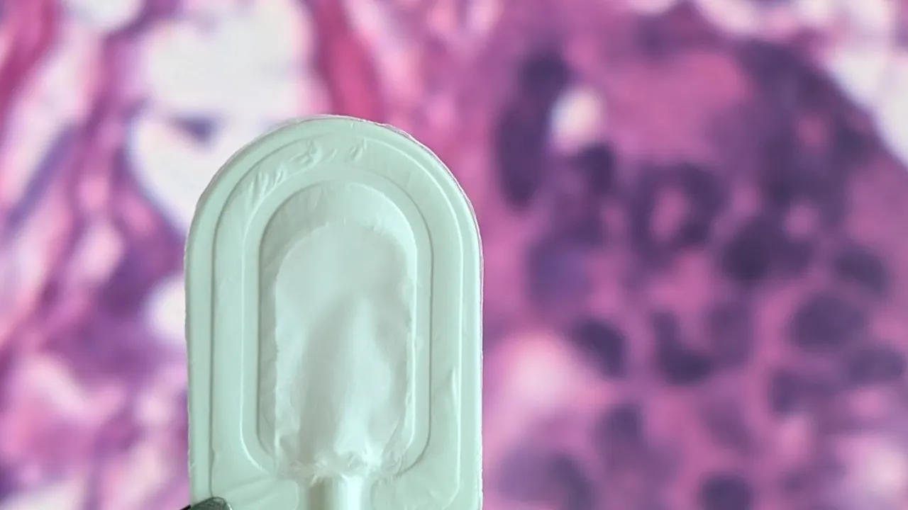 Image from breakthrought1d.ca: Encapsulated Islet Device Shows Early Promise in First Human Trial