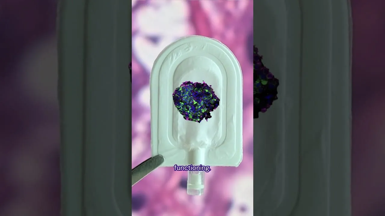 Video still from YouTube community video: An Implant Designed to Protect Insulin-Producing Cells Shows Early Promise