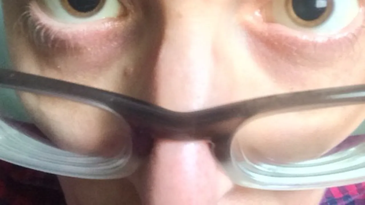 This guy just got back from a checkup at the eye doctor!