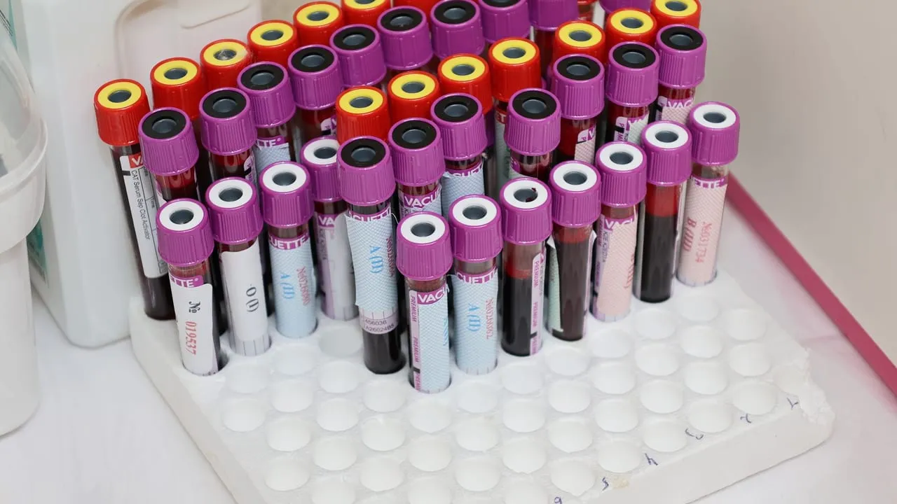 Rows of blood vials in a laboratory setting, ready for analysis.