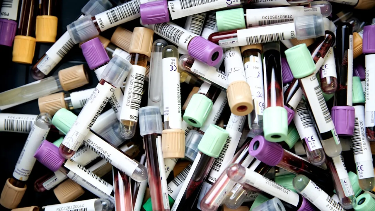 assorted color pen lot on white table