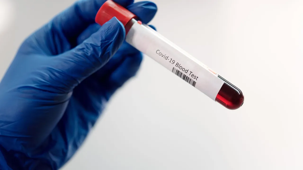 Medical professional holding Covid-19 blood test sample in laboratory, highlighting healthcare research.
