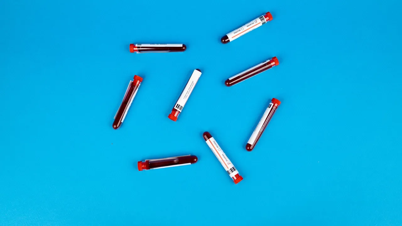 Multiple blood sample tubes arranged on a vivid blue background.