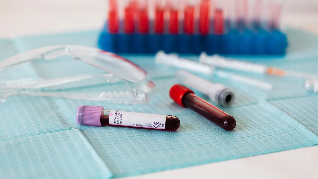 Closeup of full vials of blood placed on medical diaper near plastic eyeglasses and syringes and test tubes in container