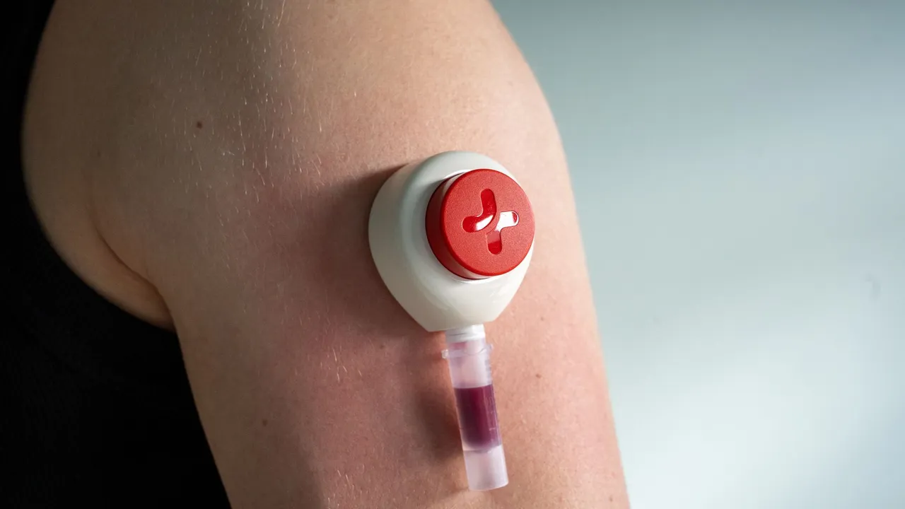 Close-up of a modern blood collection device attached to a person's upper arm for medical use.