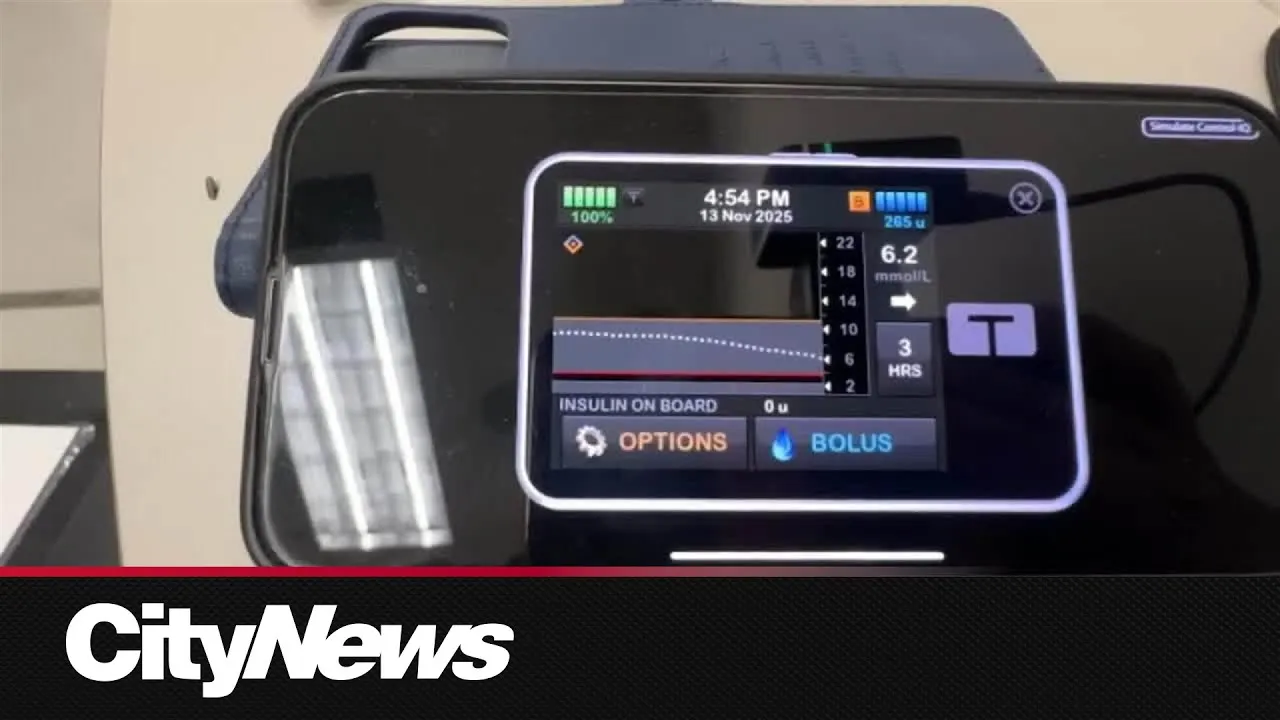 Video still from YouTube / CityNews: New Automated Insulin System Shows Promise for Pregnant People with Type 1 Diabetes