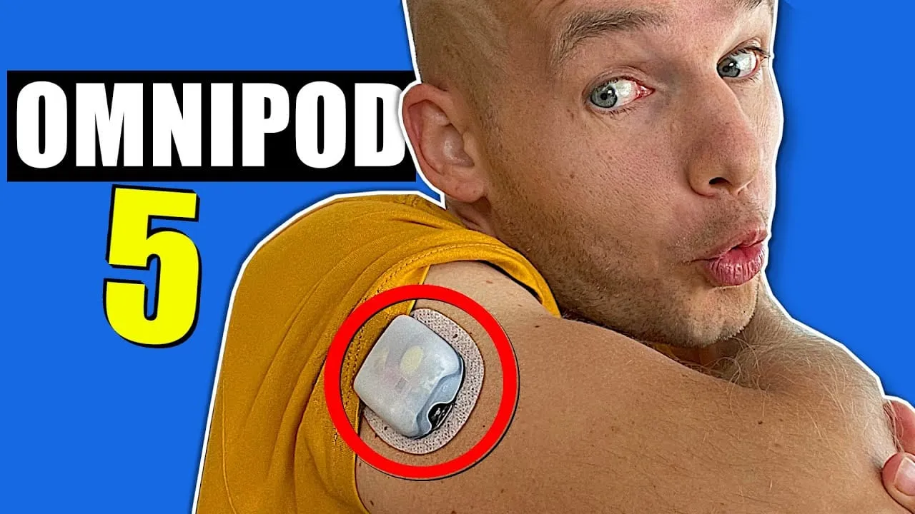 Video still from YouTube community video: Omnipod 5: What You Need to Know About the Tubeless Automated Insulin Pump