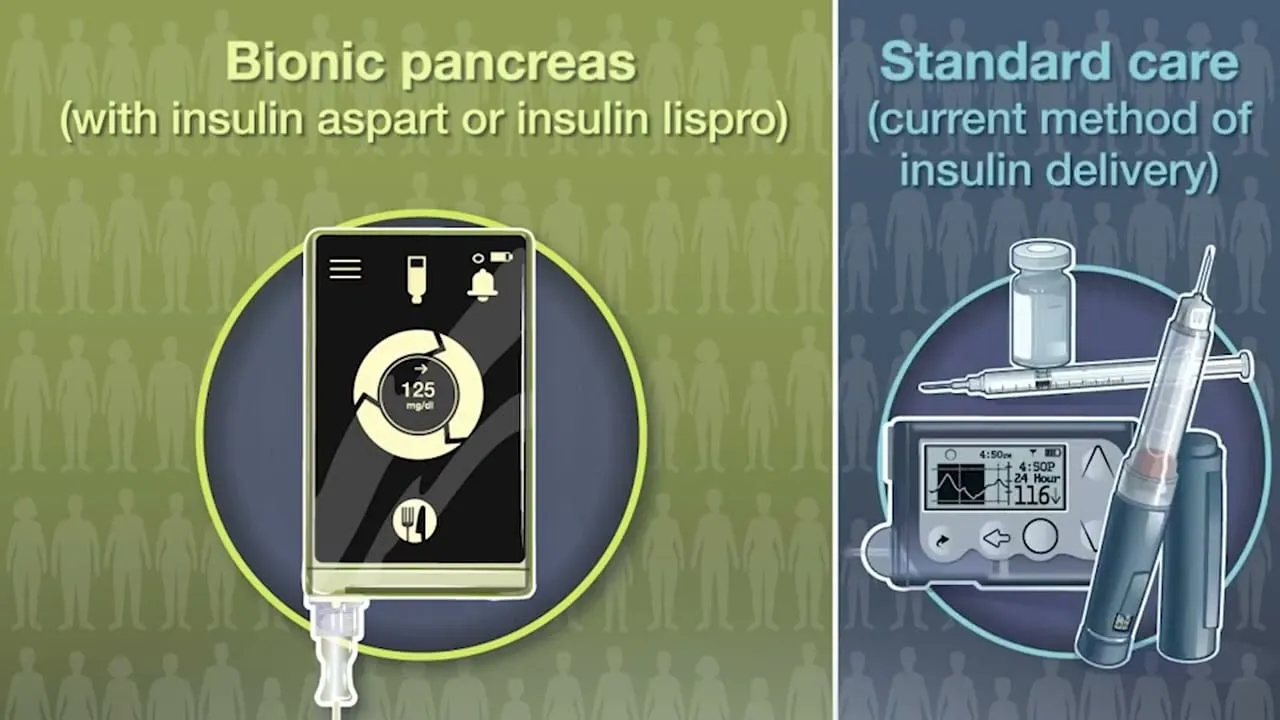 Video still from YouTube community video: Toward Smarter Insulin Pumps: Researchers Work to Predict, Not Just React to Blood Sugar Changes