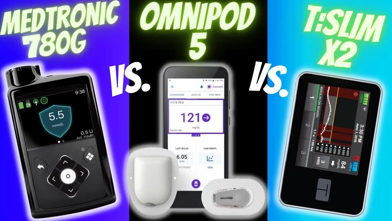Video still from YouTube community video: Understanding the CGM Systems Behind Three Popular Insulin Pumps